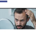 ریزش مو بعد از رژیم