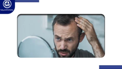 ریزش مو بعد از رژیم