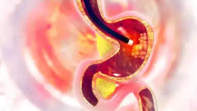 آندوسکوپی شب و تعطیلات