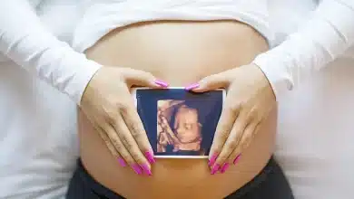 سونوگرافی چهار بعدی