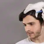 بهترین مرکز پی آر پی مو در تهران