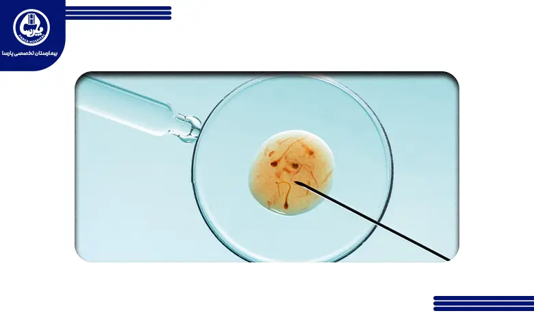 آی وی اف چیست؟